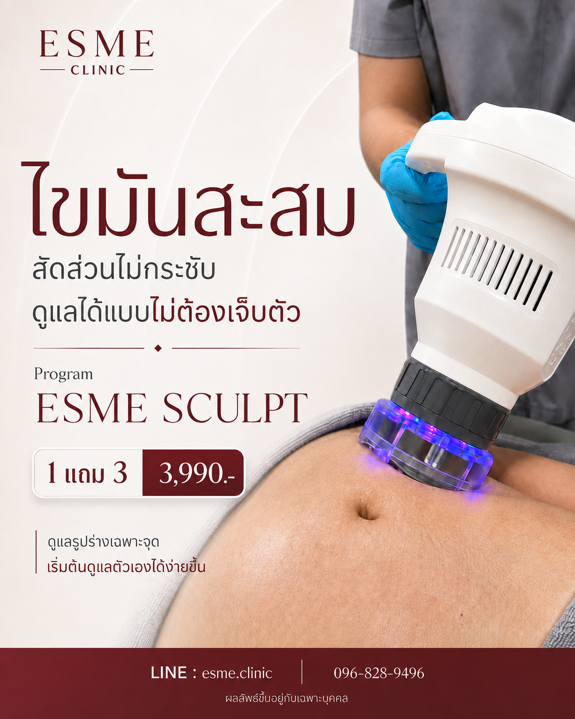 ดูแลไขมันสะสมเฉพาะจุดที่แก้ยาก